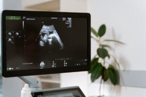 Antenatal care