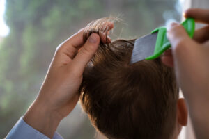kutu rambut